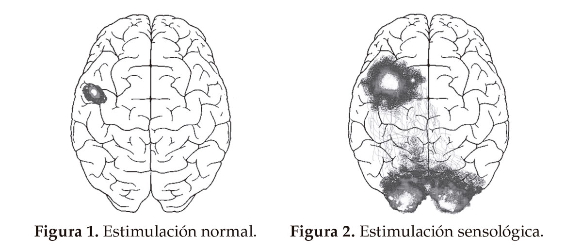 Cerebro.jpg